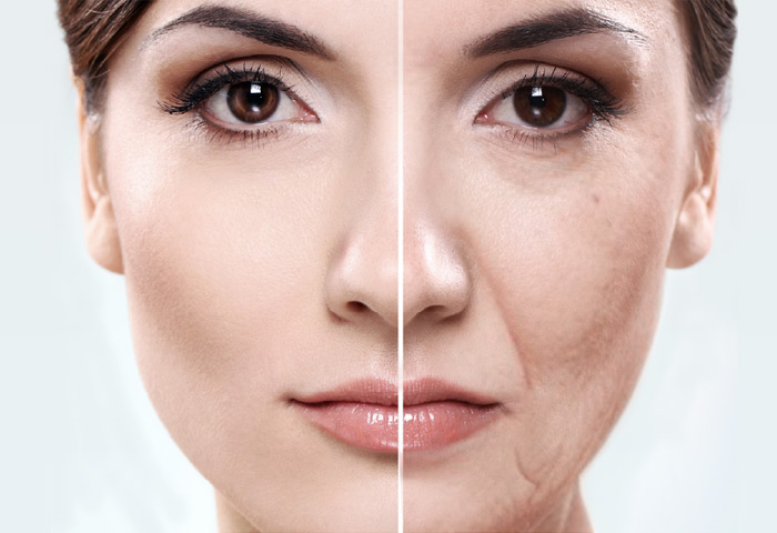 03-Lifting-facial