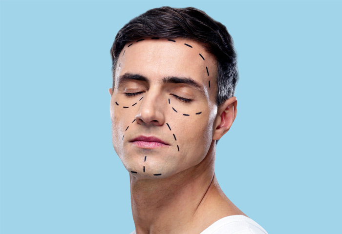 07-Lifting-facial