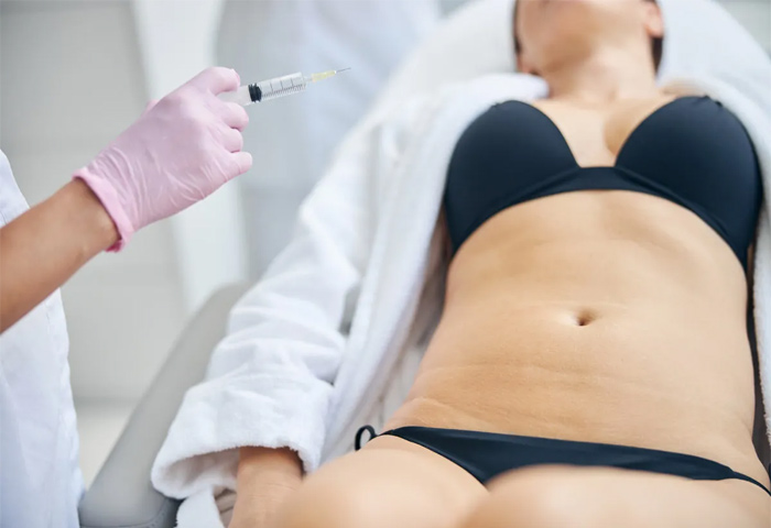 1-Flacidez-abdominal-Radiesse