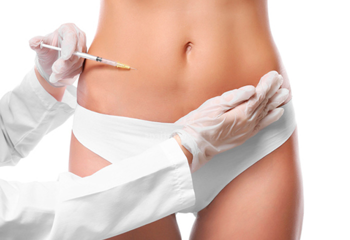 2-Flacidez-abdominal-Radiesse
