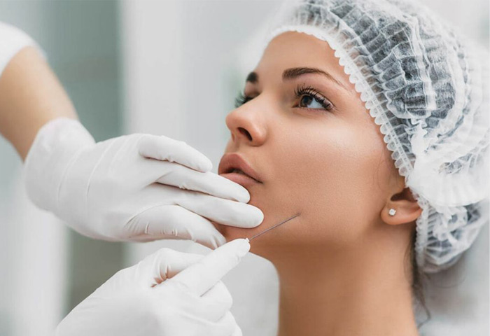 2-Lifting-facial-con-hilos-tensores