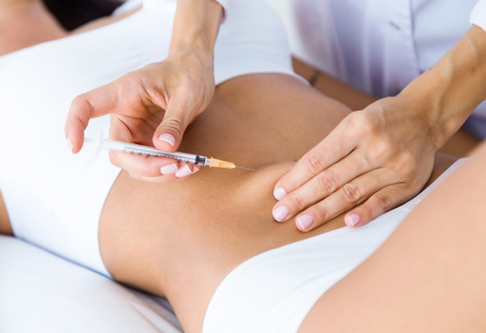 5-Flacidez-abdominal-Radiesse