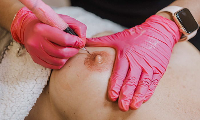 05-Micropigmentacion-de-areolas-y-pezones